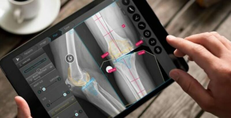 TraumaCad® world-class orthopaedic & spinal surgical templating program